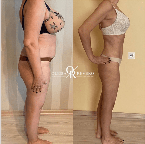 Screenshot 2023-10-09 at 22-16-22 Nutritionist_olesia.png